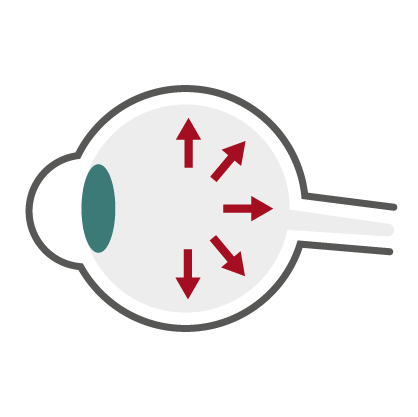 Services by Dr Vrahimi - Glaucoma. Υπηρεσίες από την Δρ Βραχίμη - Γλαύκωμα